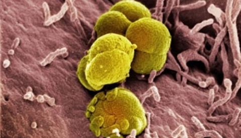 Bệnh lậu ở hậu môn và dấu hiệu nhận biết