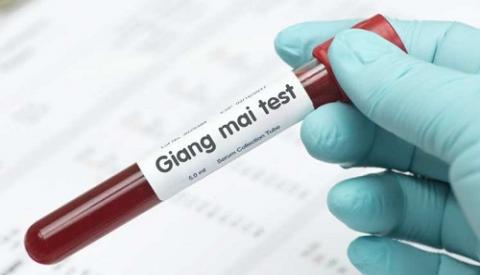 Cách test phát hiện bệnh giang mai chính xác