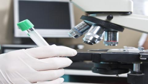 L&agrave;m những x&eacute;t nghiệm g&igrave; để biết mắc mụn rộp sinh dục